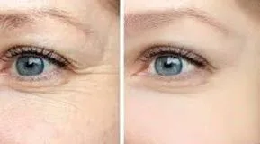 Skin Rejuvenation - Eye and hair support